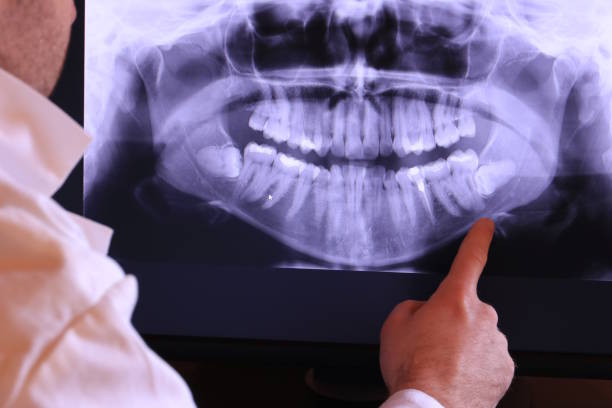 Best Emergency Broken Tooth Repair in Darien, GA